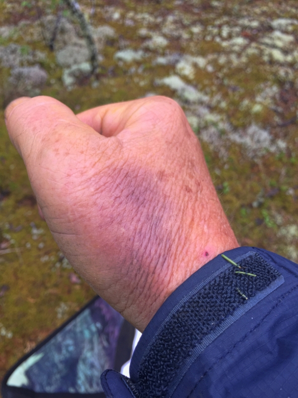 IMG_2439.jpg - Bruised