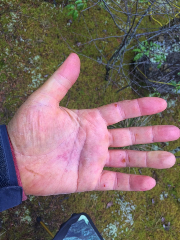 IMG_2441.jpg - Sore hands